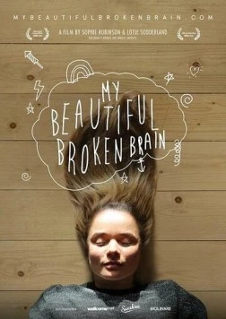 Мой прекрасный сломанный мозг / My Beautiful Broken Brain (2014)